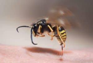 stinging insects need stinging insect control. wasp stinging person.